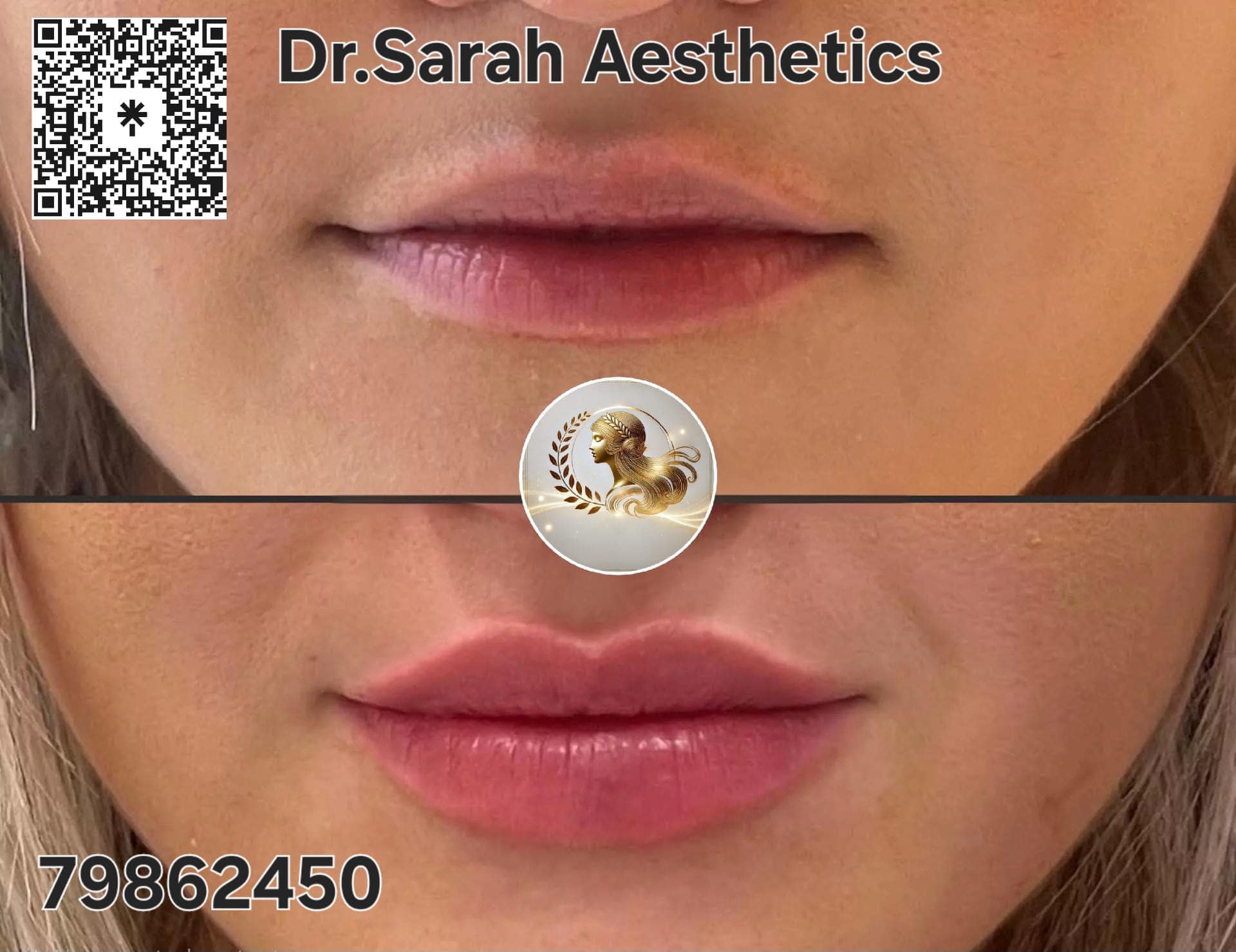 Dr.Sarah Aesthetics Facebook ad: Plump, define, and perfect your lips with expert…