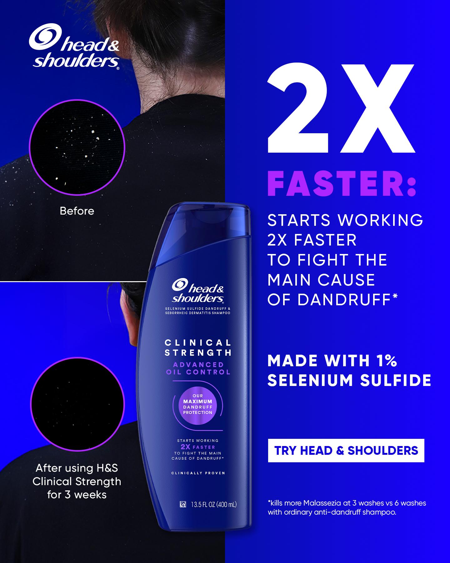 Head and Shoulders Facebook ad