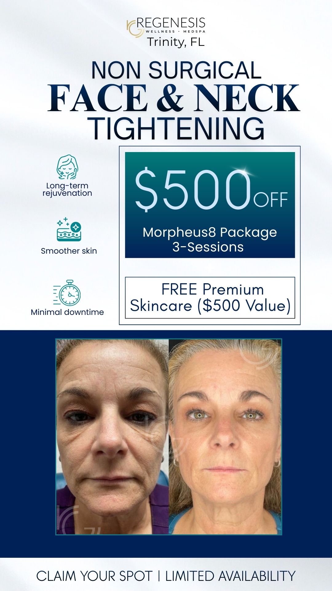 ReGenesis Wellness & Medspa Facebook ad from Jan 29, 2026