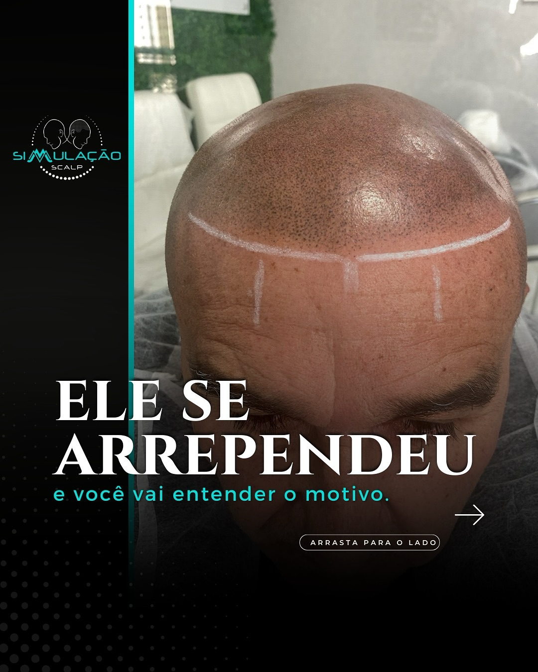 Simulação Scalp  Facebook ad