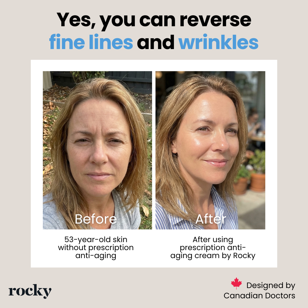 Rocky Health Inc Facebook ad