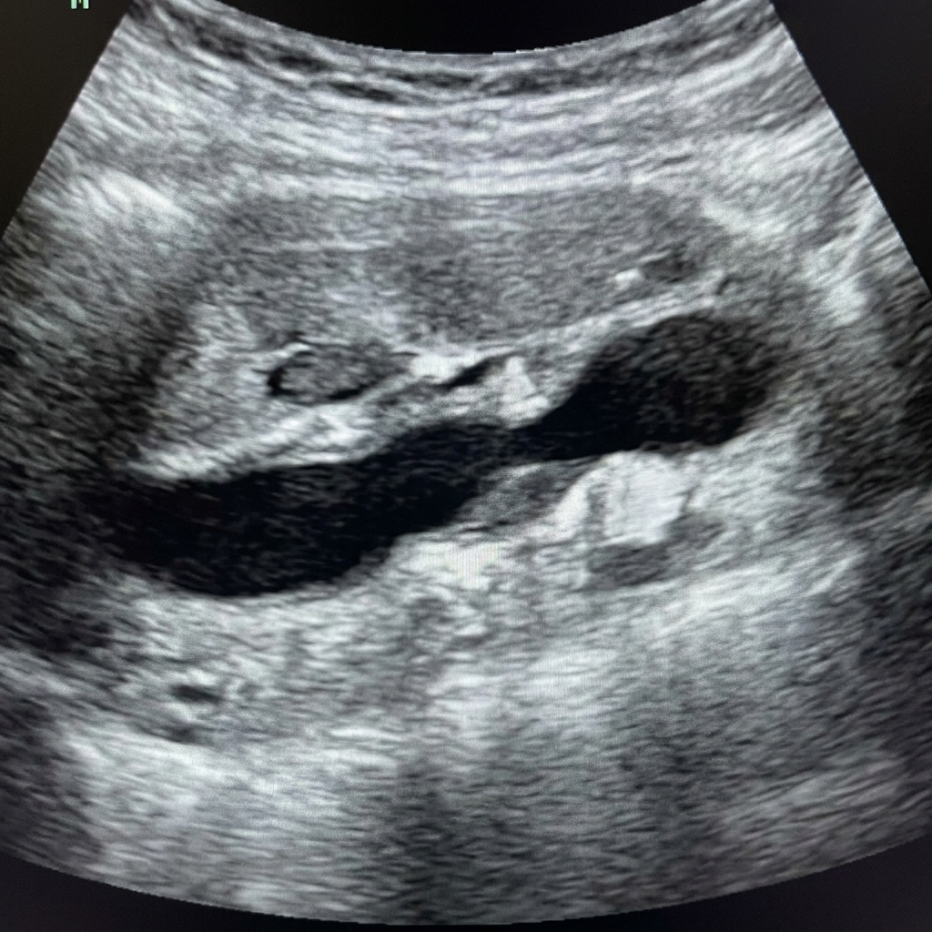 Noel Arvel Facebook ad: Cardiologist Goes Rogue: This 'Berry' Cleans Penile…