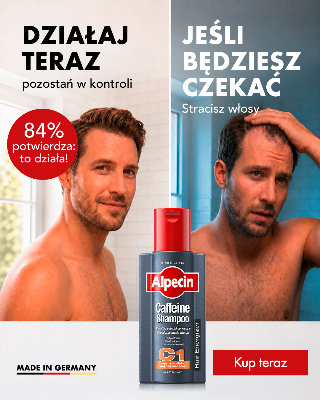 Alpecin Facebook ad: Doping dla Twoich włosów