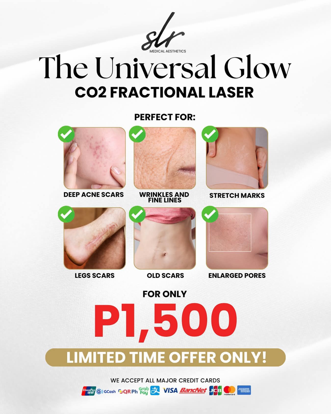 SLR Medical Aesthetics Facebook ad: Struggling with acne scars, wrinkles, stretch marks, leg…