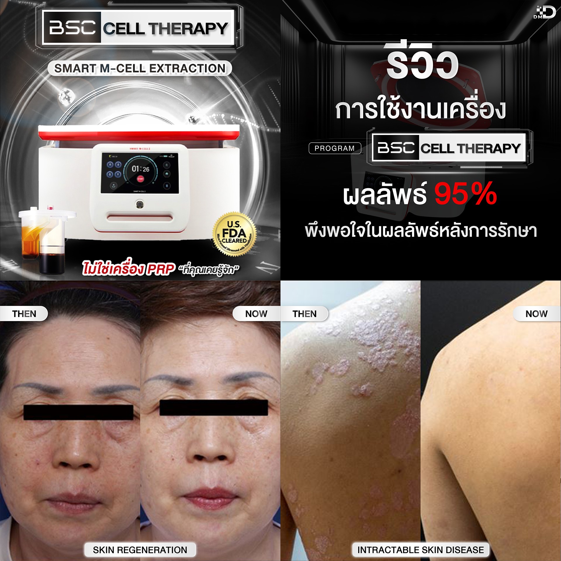 Deserve Medical Device Facebook ad: เปิดมิติใหม่แห่งการฟื้นฟูสุขภาพด้วยเทคโนโลยี SM Cell…