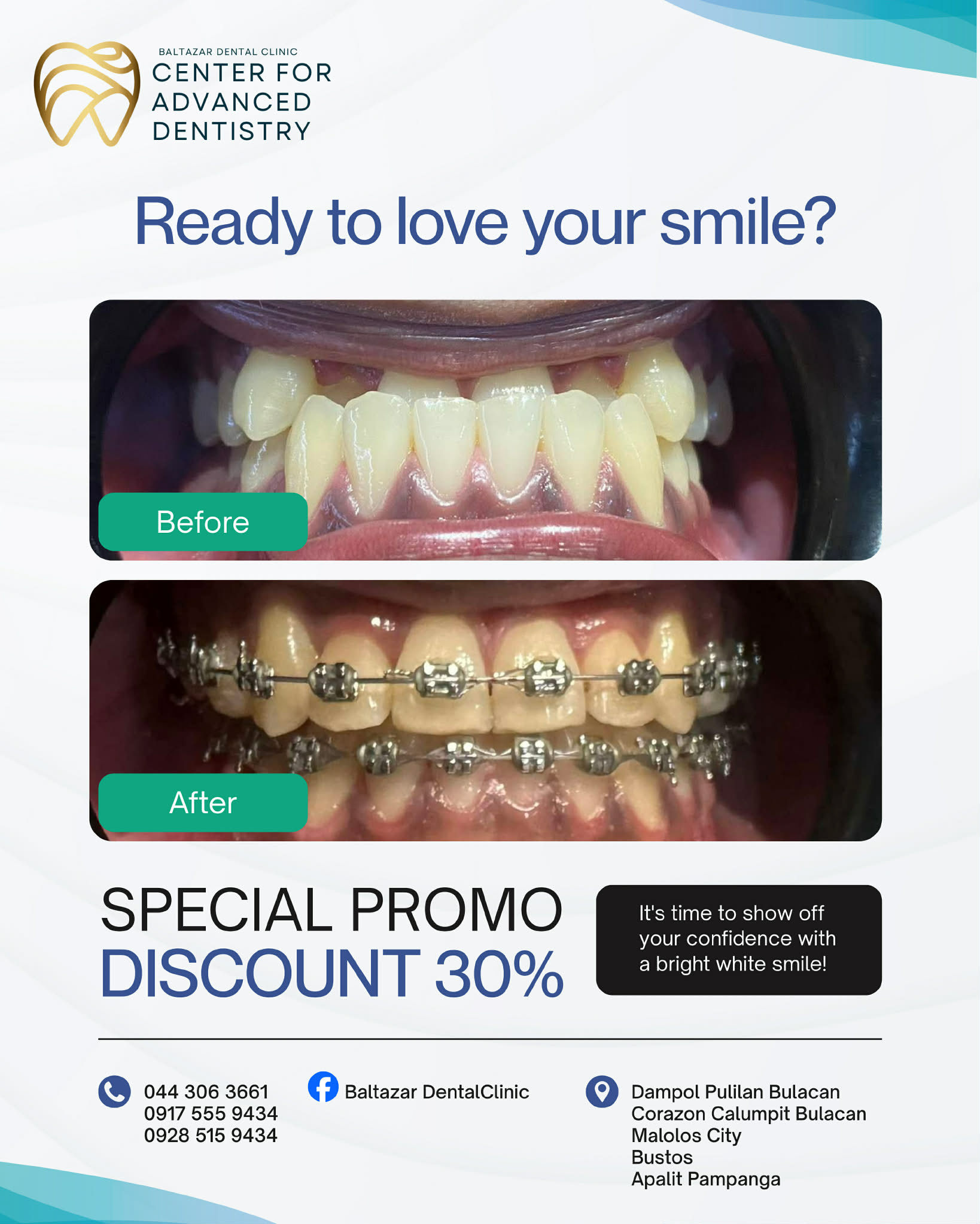Baltazar Dental Clinic - Center for Advanced Dentistry Facebook ad: Baltazar Dental Clinic - Center For Advanced