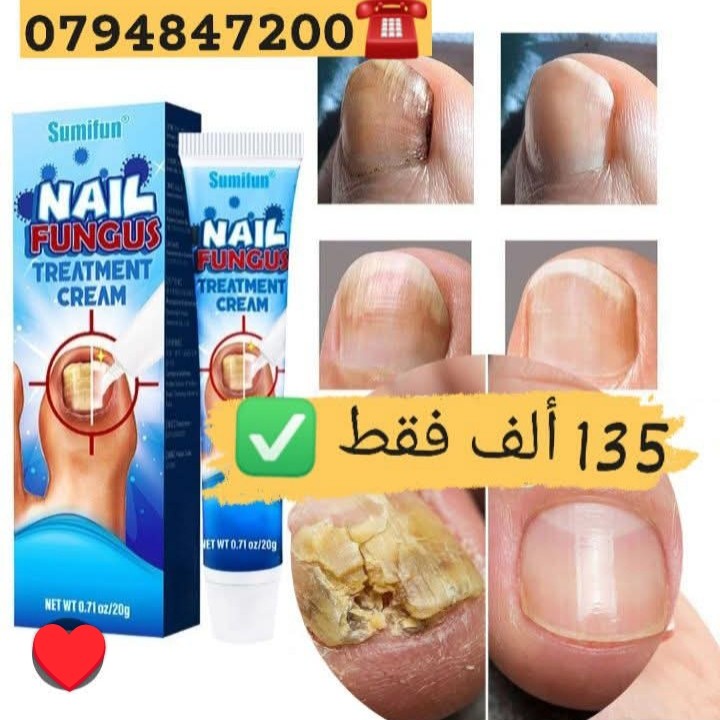 Bibou shop.dz Facebook ad: أصلية مستوردة إحذروا تقليد