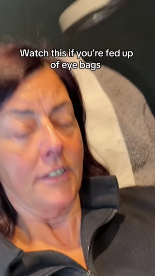 Dr.Melaxin UK Facebook ad: How to care for eye bags without surgery to remove fat…