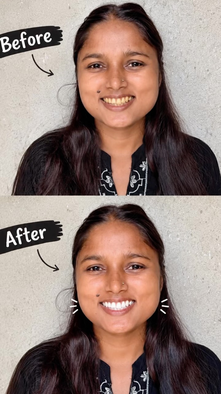 Perfora Care Facebook ad: Perfora purplle teeth whitening toothpaste