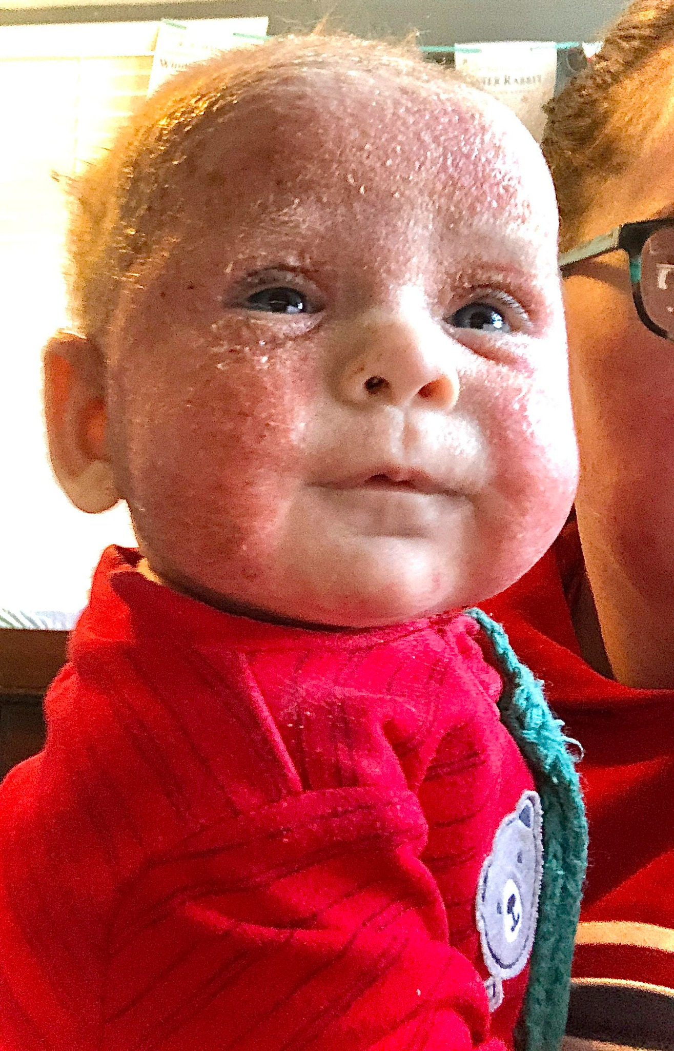 Jessica Rossi Facebook ad: Read this if your baby has eczema