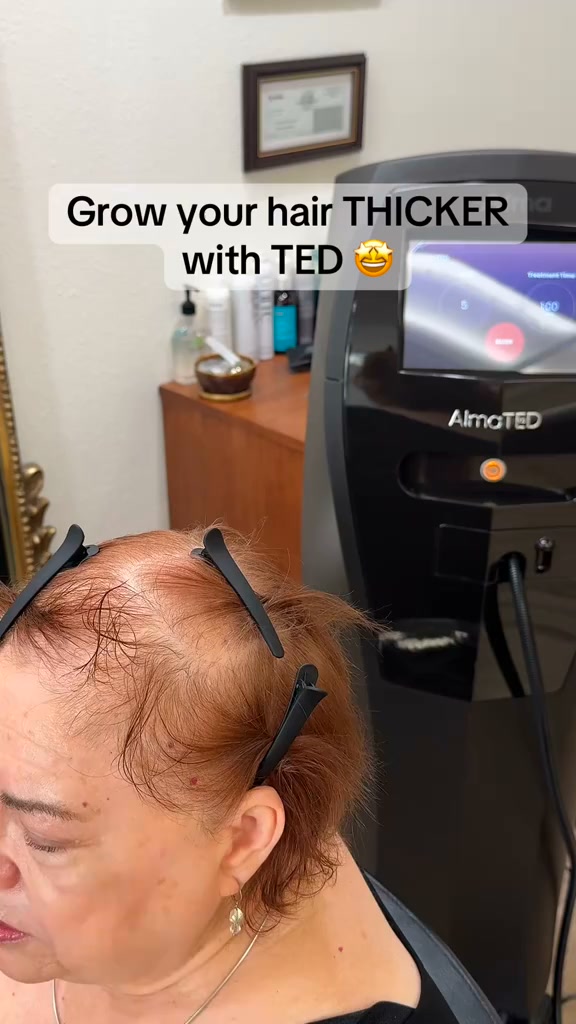 Elite MD Aesthetics Facebook ad: Markham: Hair Restoration From $199/Month
