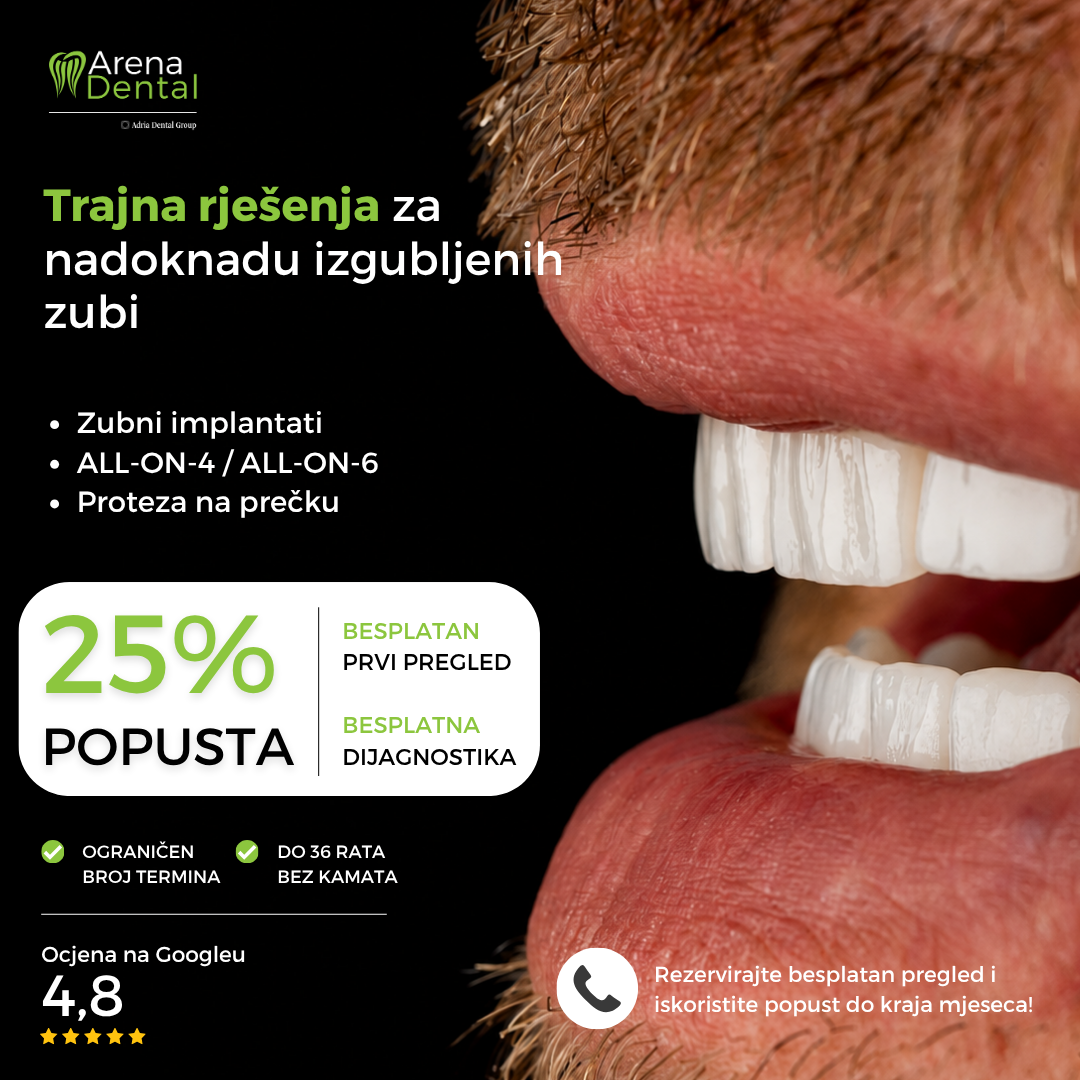 Arena Dental Facebook ad
