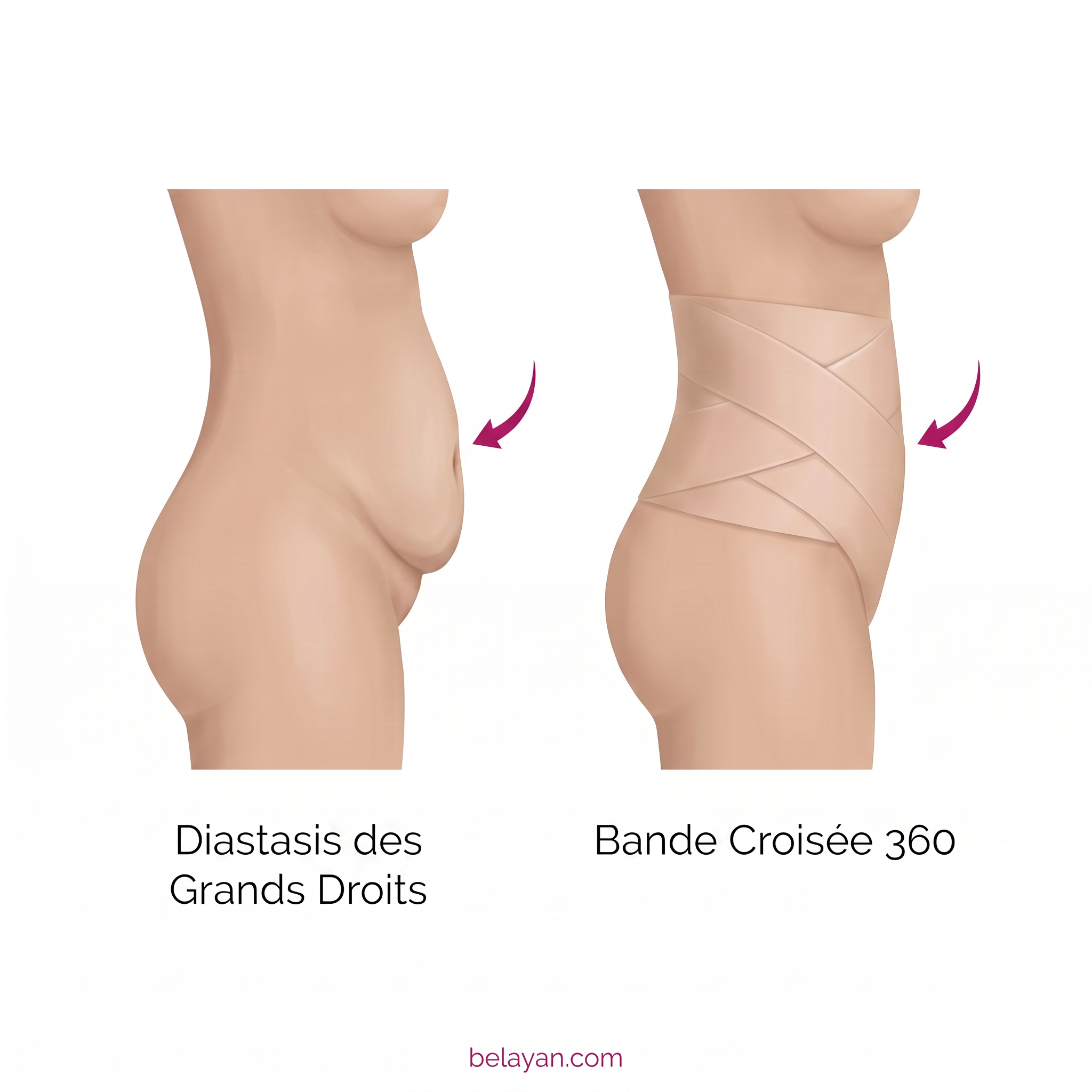 Belayan Facebook ad: 935 € en trois ans pour mon ventre après l'accouchement…