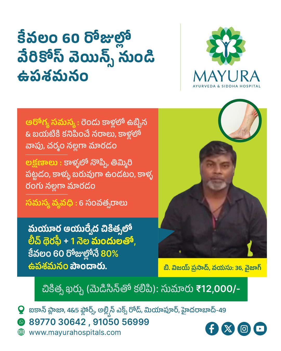 Mayura Hospitals Facebook ad: Say Goodbye to Varicose Veins in Just 60…