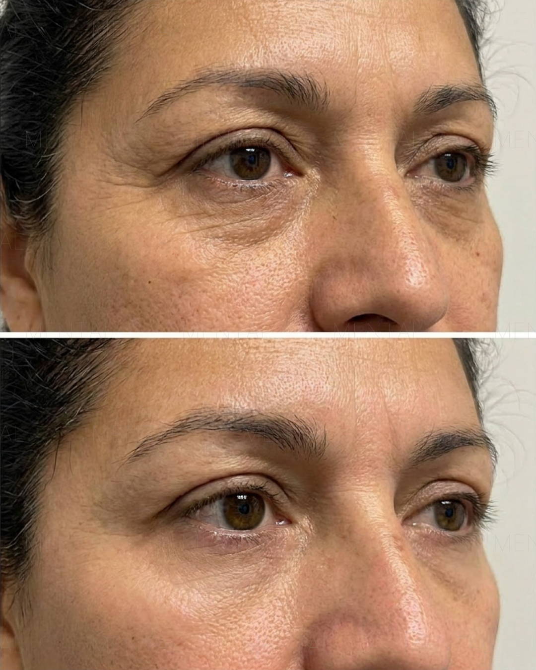 Mimika - Face Yoga Exercises Facebook ad
