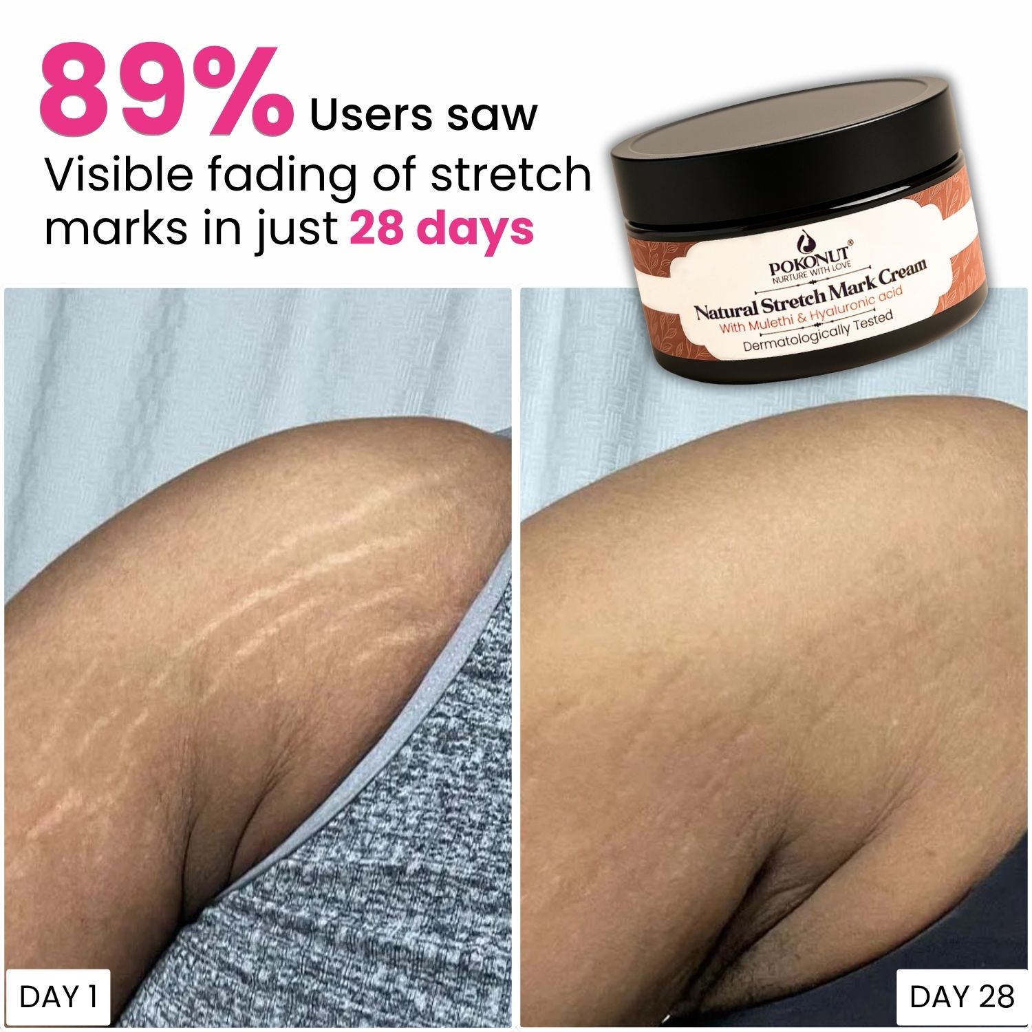 Pokonut Ayurveda  Facebook ad