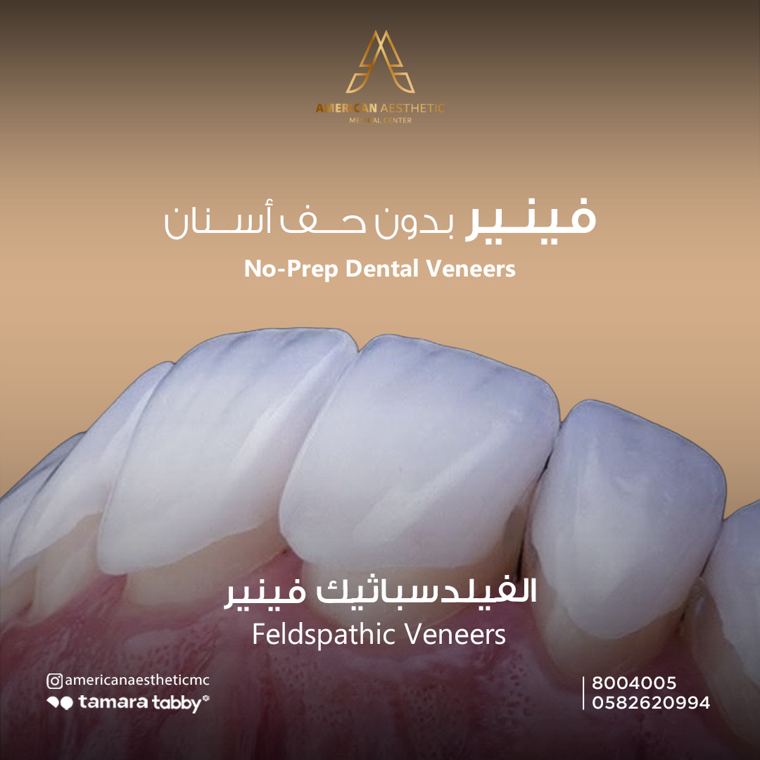 American Aesthetic Medical Center Facebook ad: بدك فينير بدون حف أسنان.