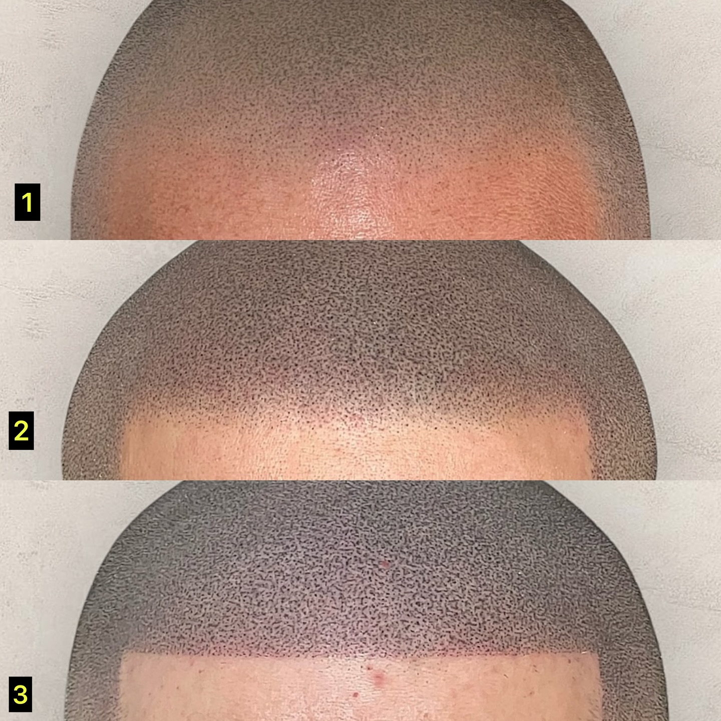 Scalptist Facebook ad: � CUSTOM HAIRLINE TATTOOS OF THE FINEST STANDARDS