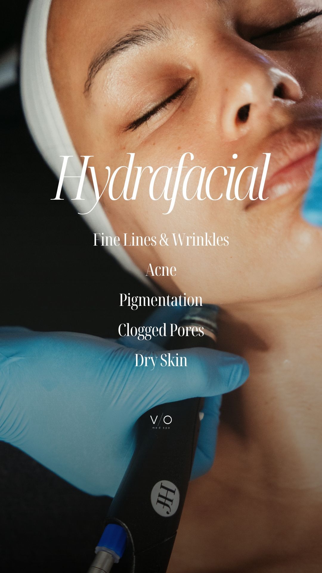 VIO Med Spa Palm Beach Gardens Facebook ad: $149 Hydrafacials at VIO Med Spa!