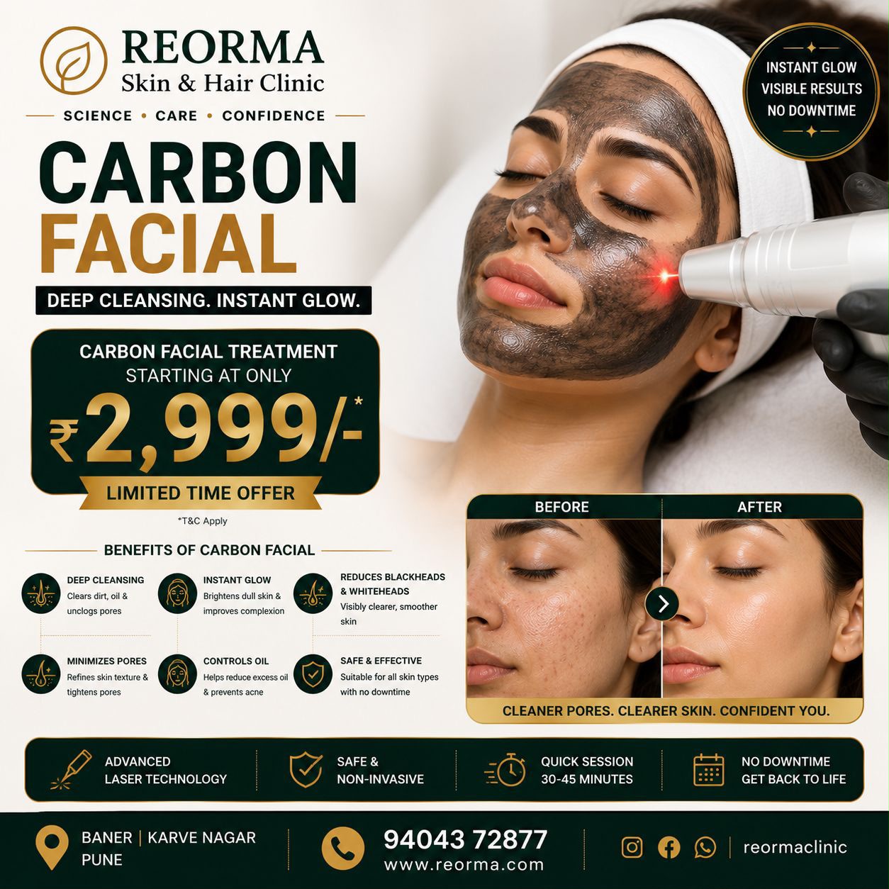 Reorma Skin & Hair Clinic Facebook ad: Carbon Facial Special Offer: Only ₹2,999/-*