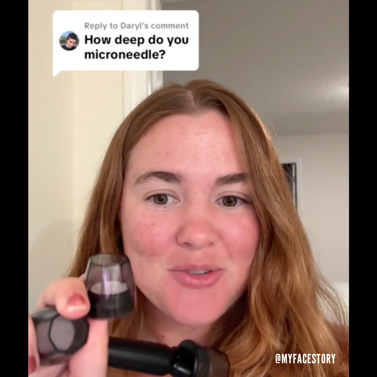 Banish Acne Scars Facebook ad