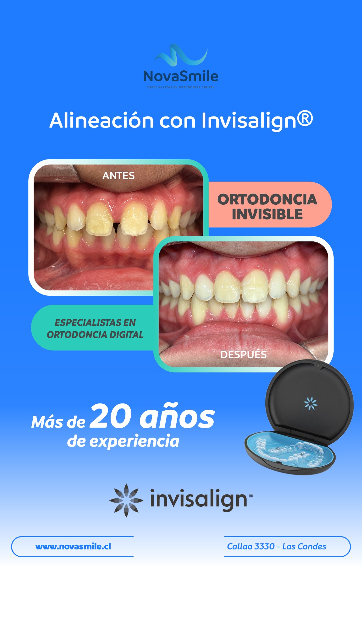 NovaSmile Facebook ad: Dile adiós a los brackets metálicos.