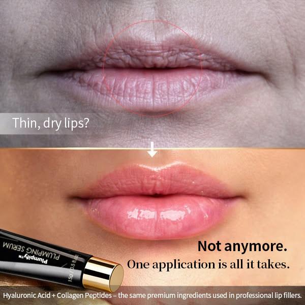 Dr. Olivia Bennett Facebook ad: Ditch the Lip Fillers: The Natural Way to Plump
