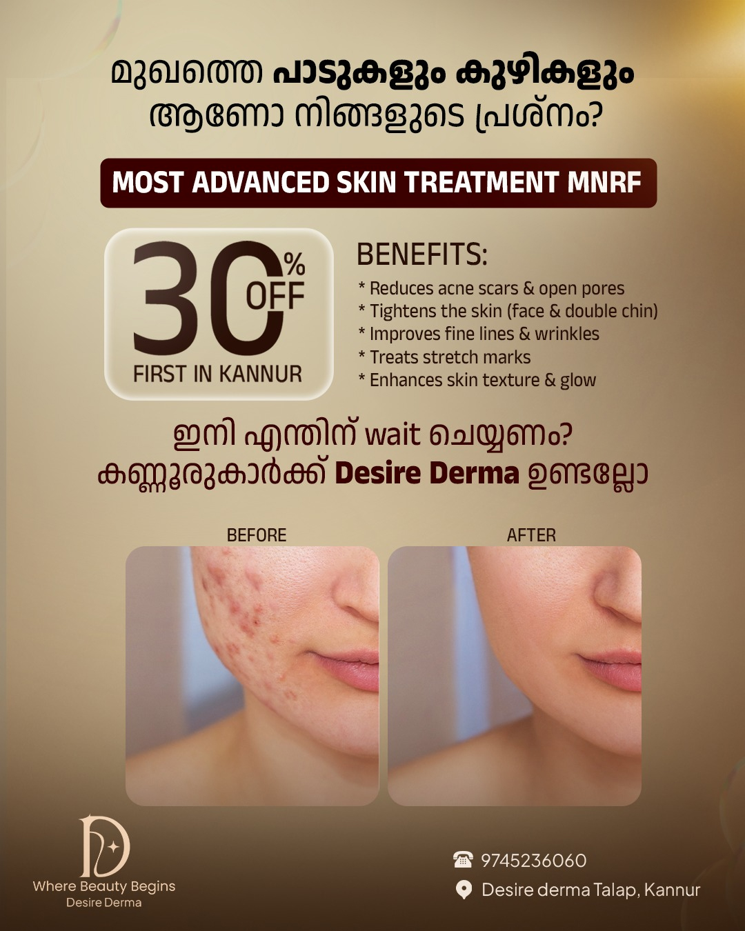 Desire Derma Skin Clinics Facebook ad