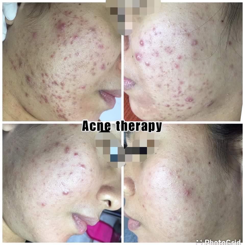 Dermagictouch Wellness Center Facebook ad