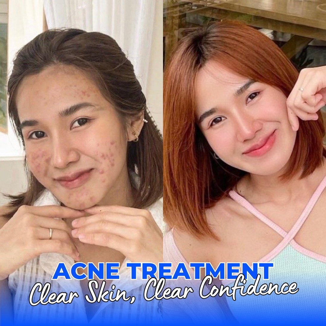Nado Clinic Davao Facebook ad