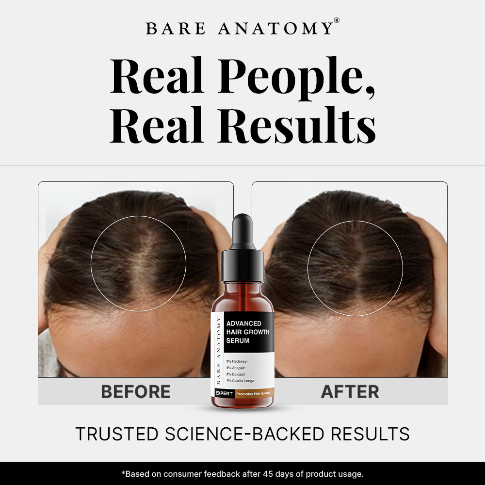Bare Anatomy Facebook ad