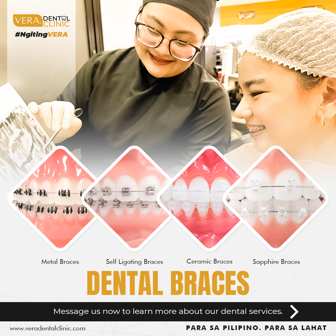VERA. Dental Clinic - Sto. Tomas Batangas Facebook ad
