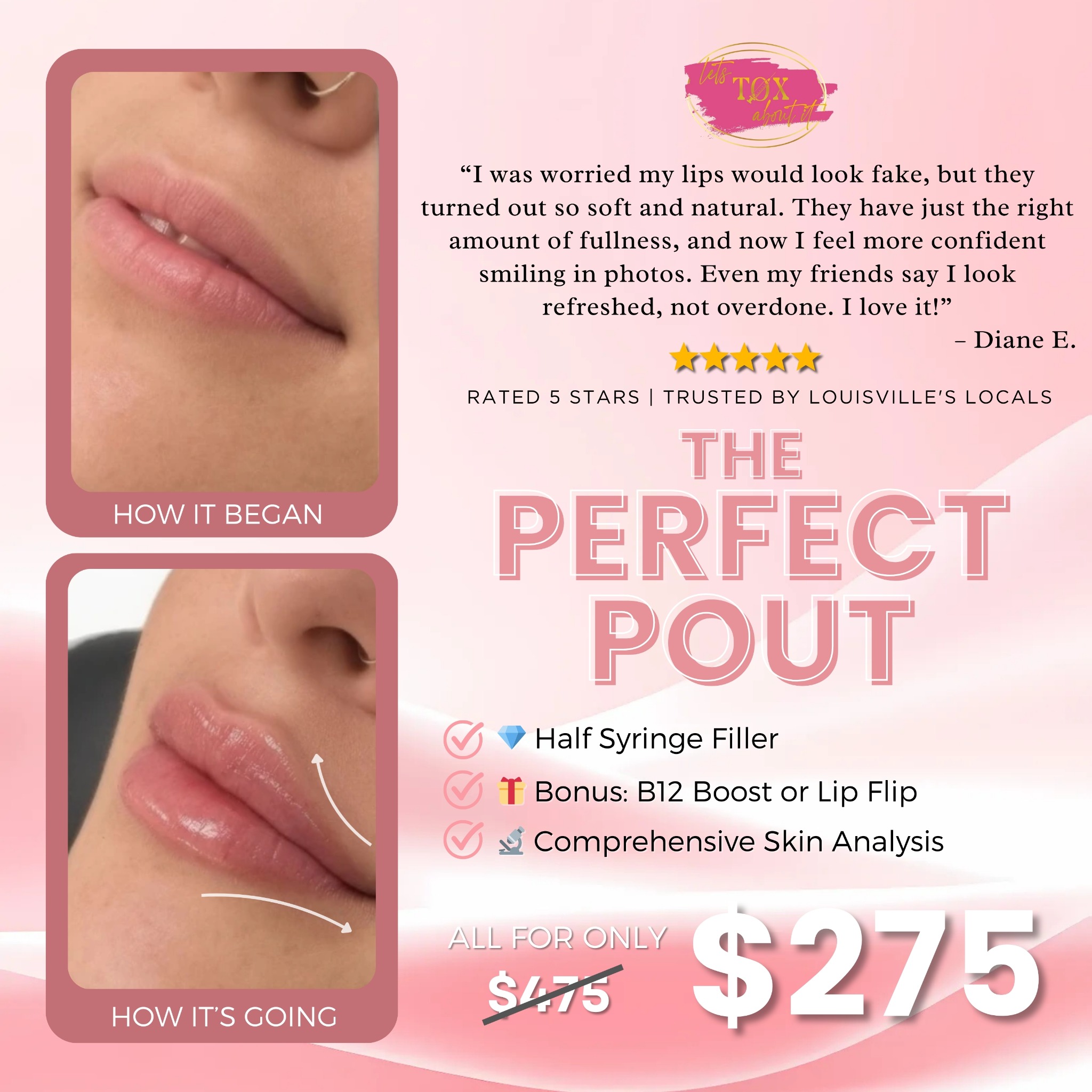 Let's Tox About it Aesthetics Spa Facebook ad: The Perfect Pout Special