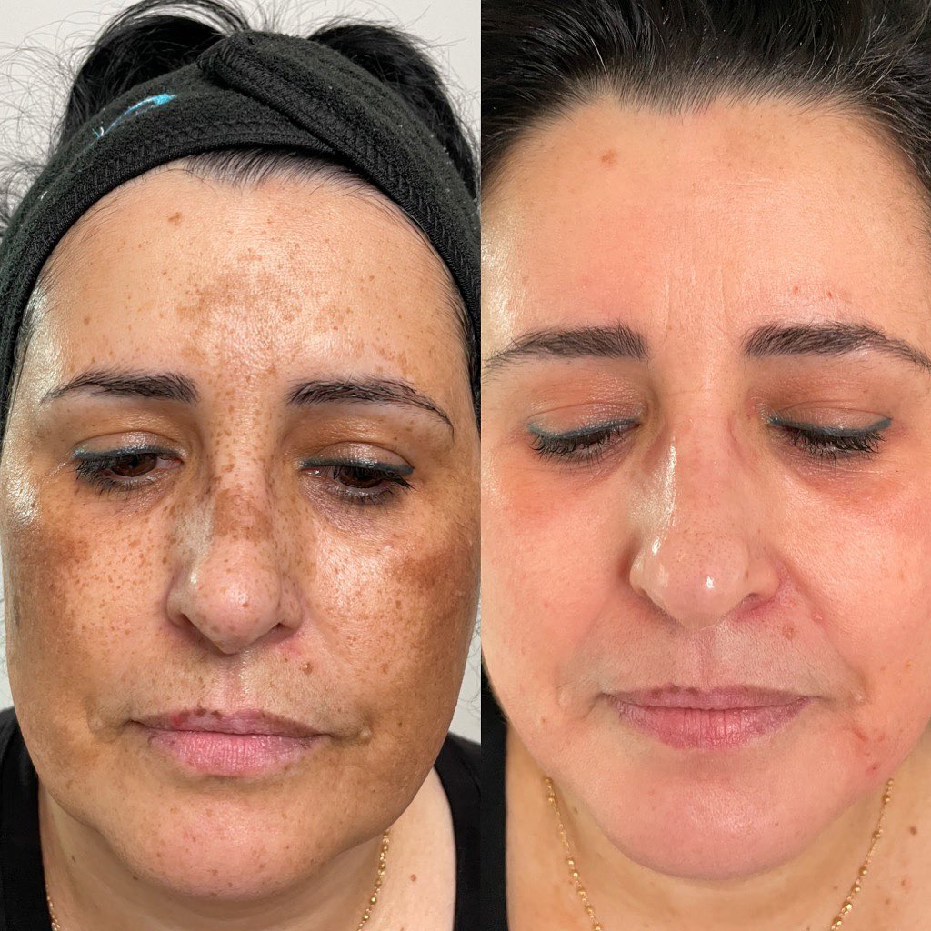 Skin Solutions Toronto Facebook ad
