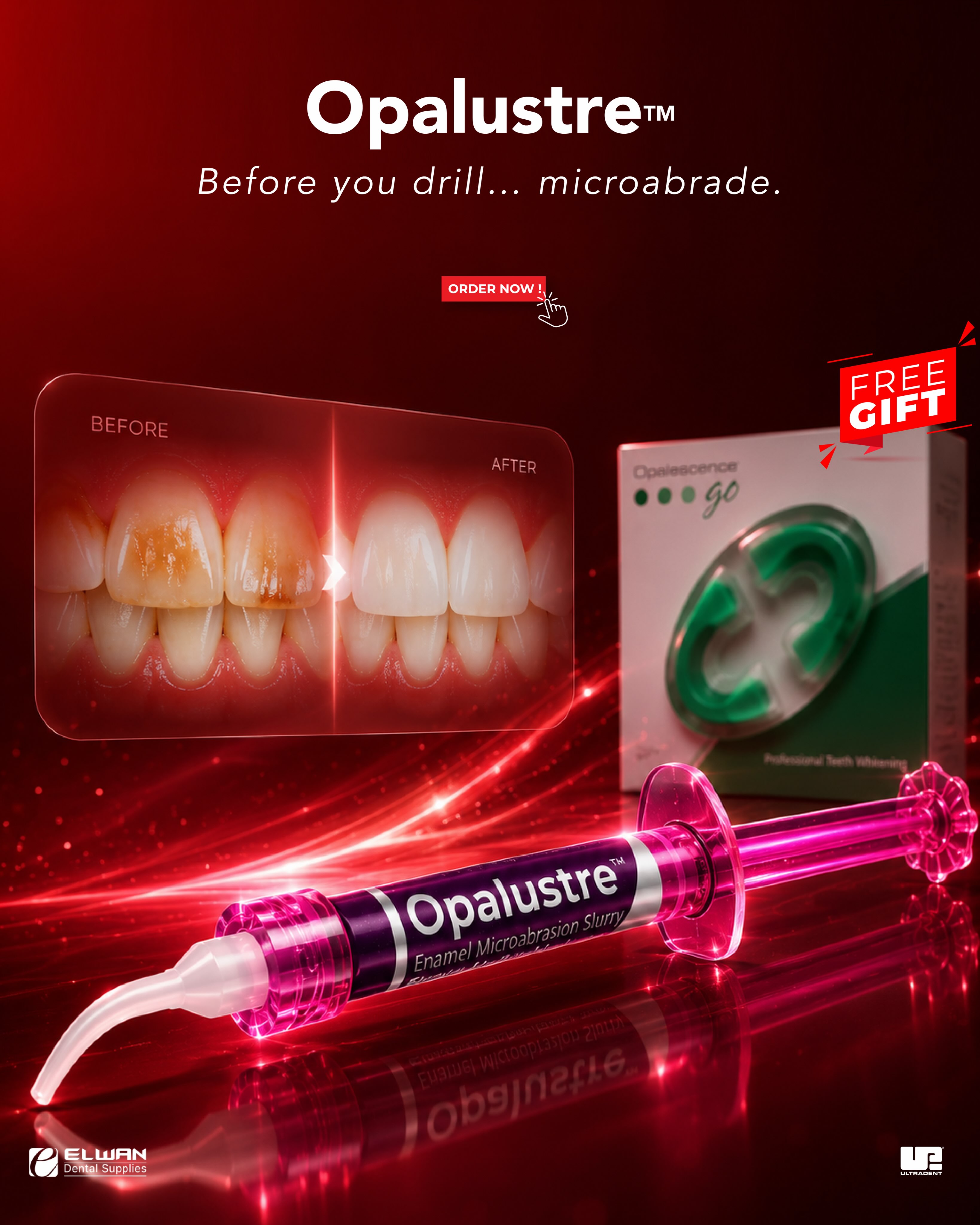 ELWAN Dental Supplies Facebook ad: Not every stain needs a drill