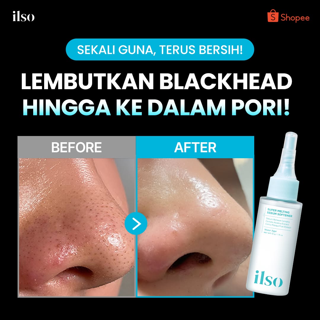 Ilso Malaysia Facebook ad
