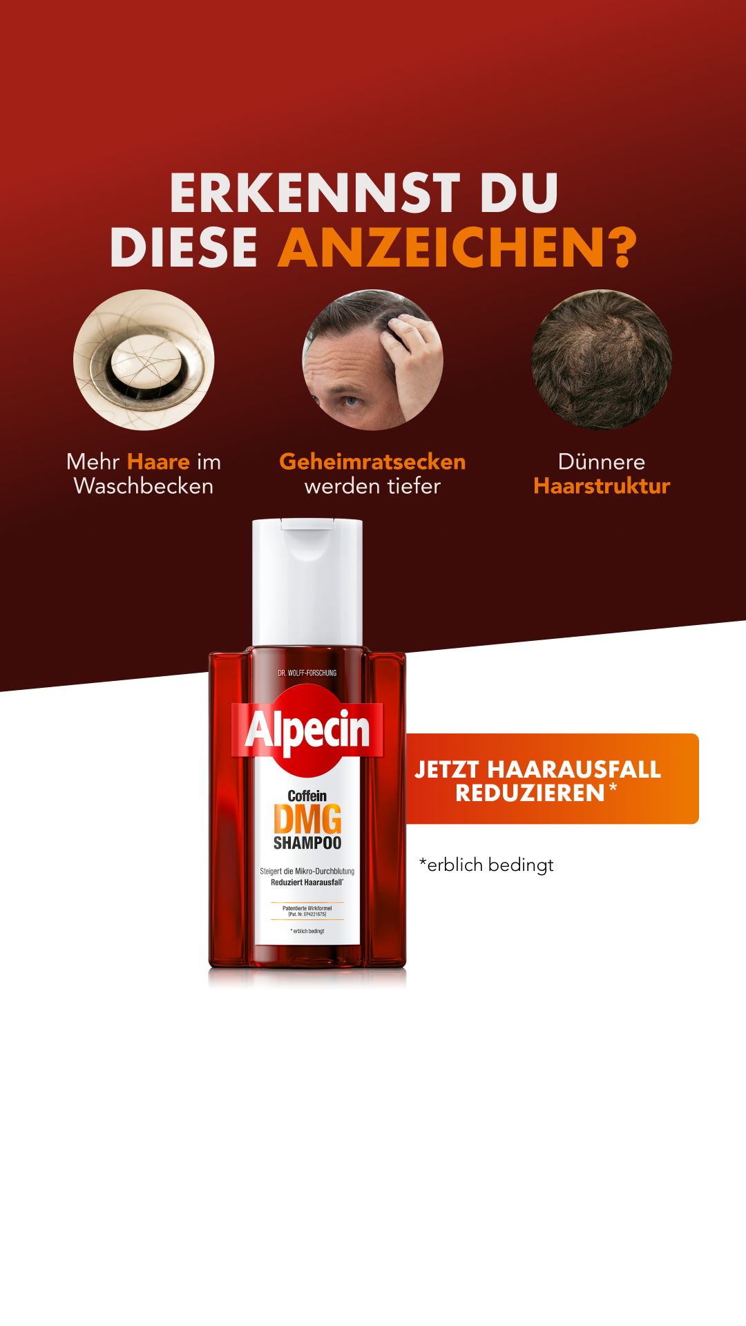 Alpecin Facebook ad