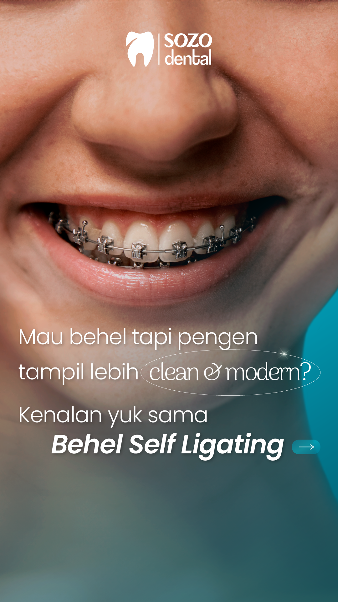 Sozo Dental Clinic Facebook ad