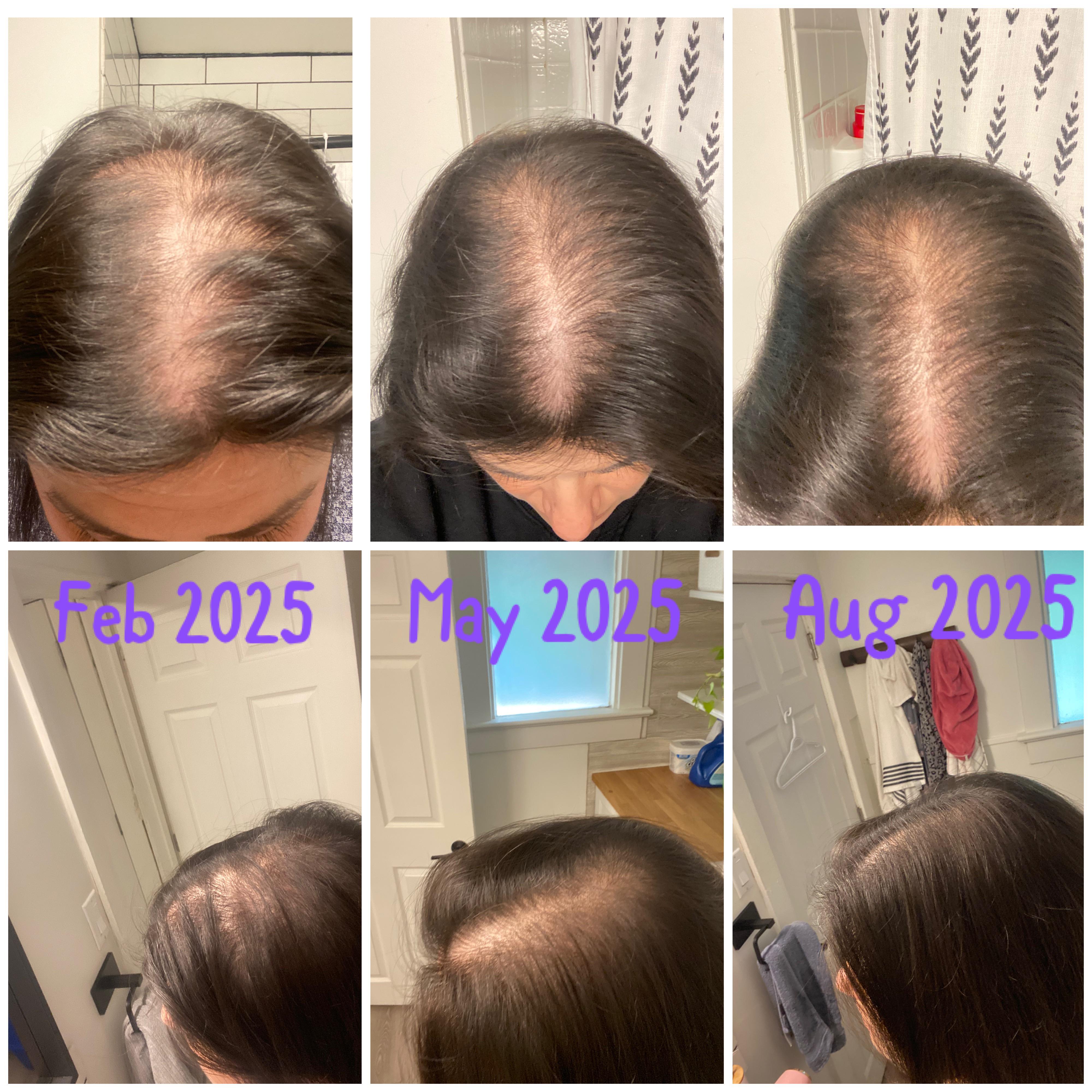 Thyroid Hair Secrets Facebook ad: Read this if the medication that's supposed to help is…