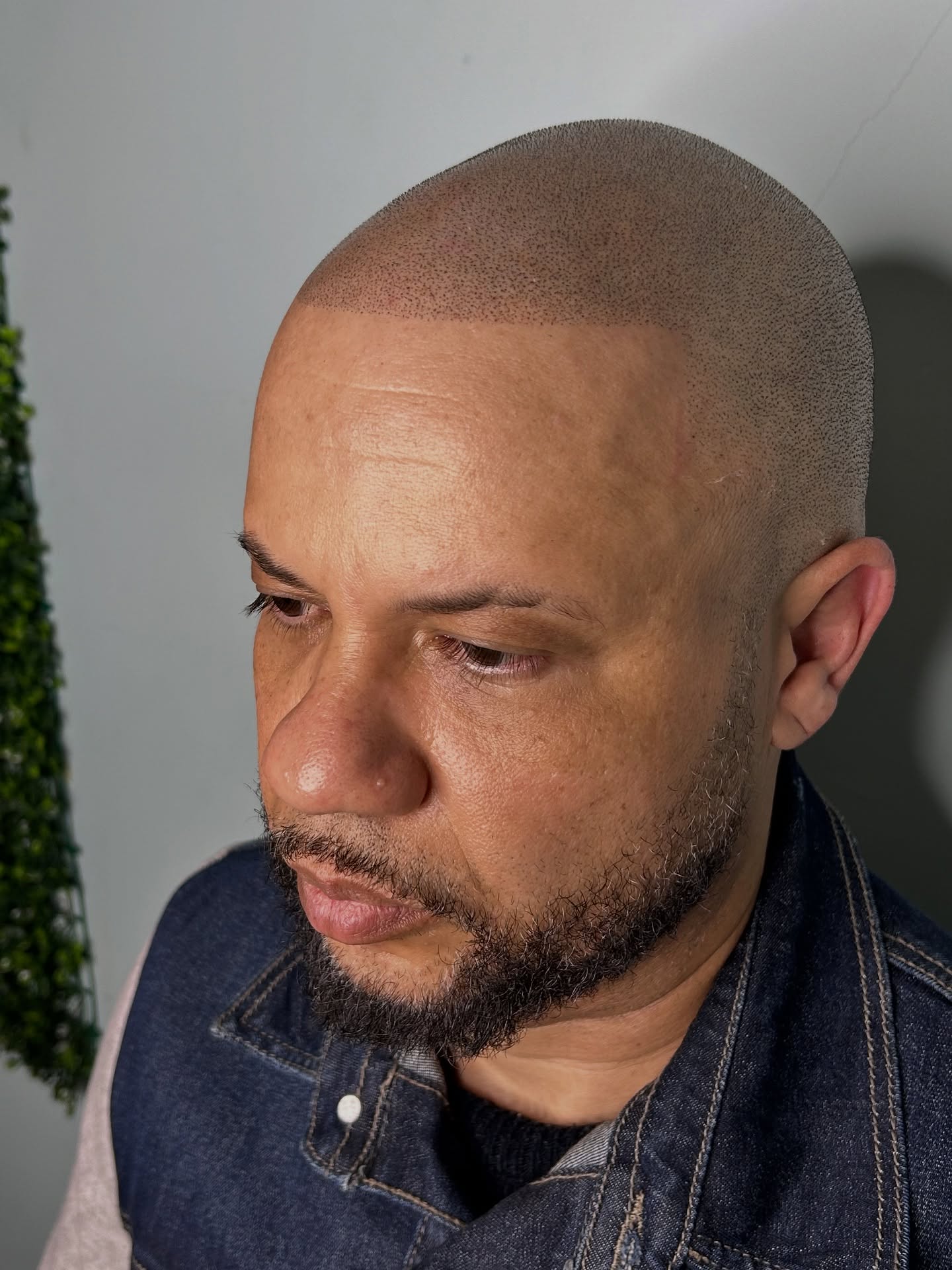 Marcio  capilar Facebook ad