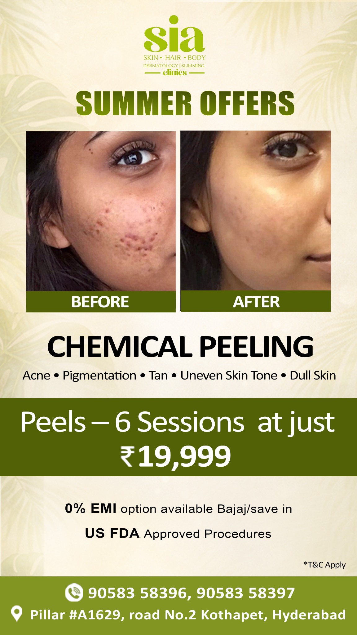 Siaclinicandsalon Facebook ad from Feb 12, 2026