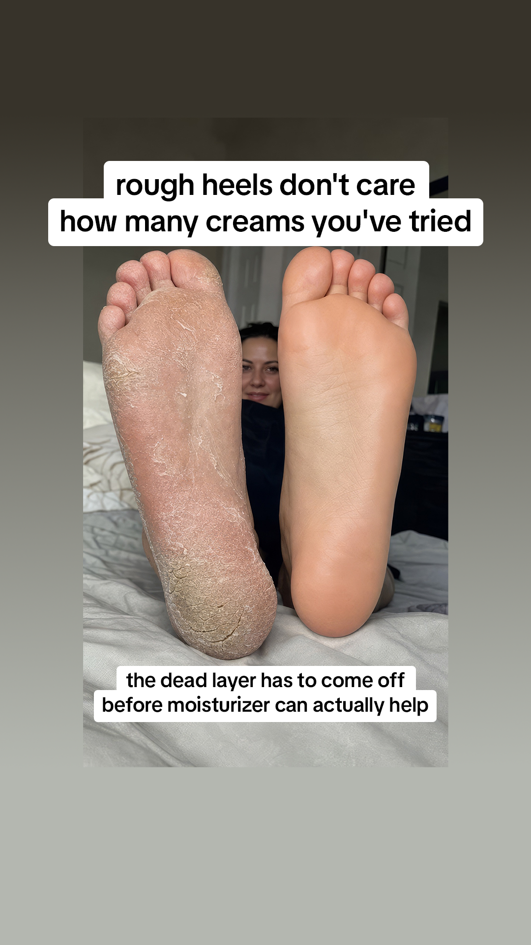 Skinmore Magazine Facebook ad: Baby soft feet in 5 minutes flat