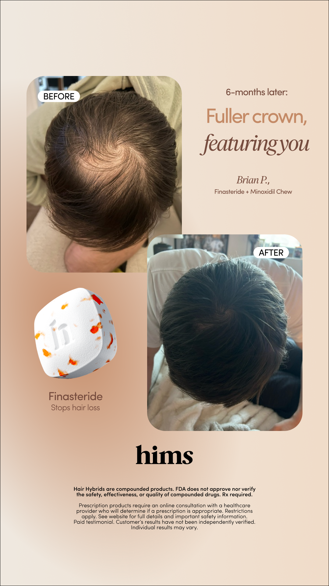 hims Facebook ad