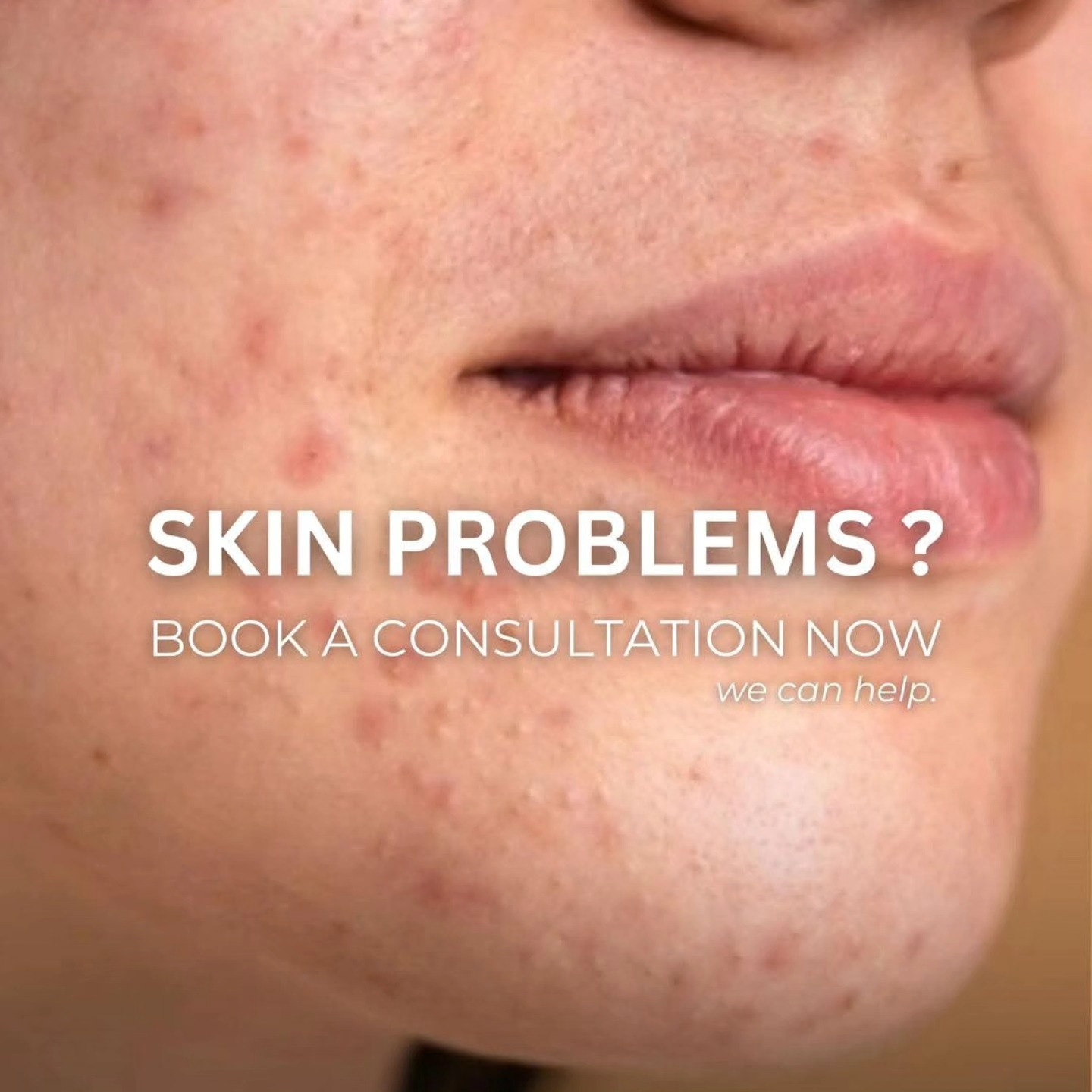 Skin Doctors - Lapu lapu City Facebook ad: Skin problems don’t all look the same