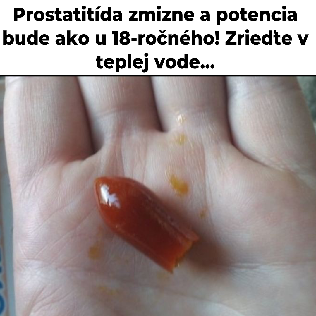 Melanie Cole Facebook ad: Kupiti Uromexil Forte jeftino. Cijene, recenzije. Naručite…