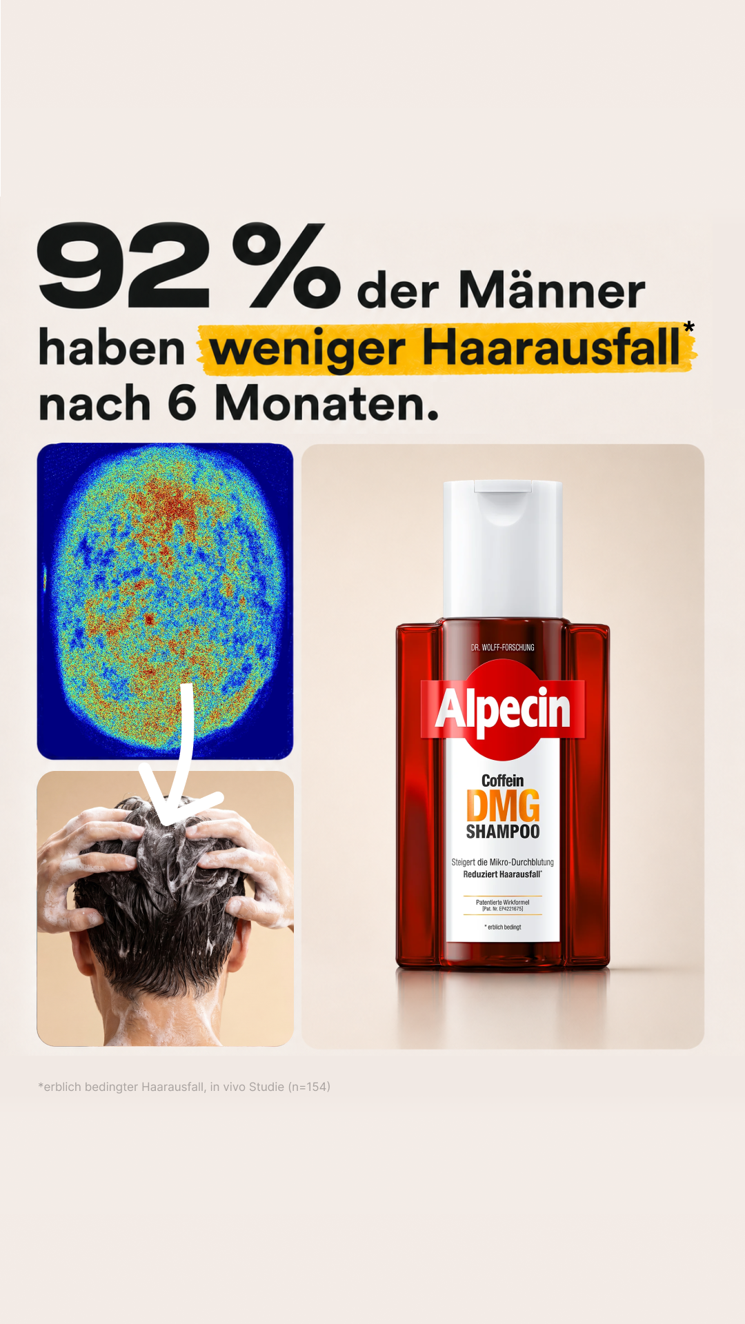 Alpecin Facebook ad