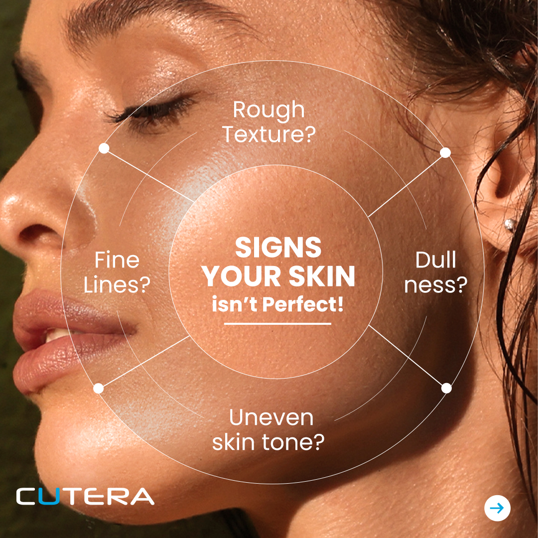 Cutera Aesthetics Facebook ad: Is Dullness, Fine lines & Uneven tone stealing…
