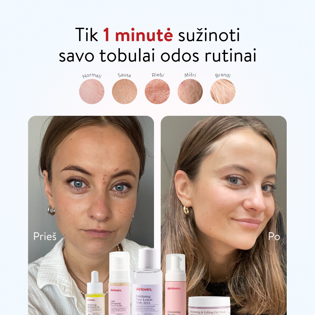 Skinlovers Facebook ad
