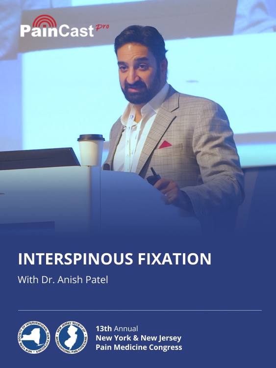 PainCast Facebook ad: Dr. Anish Patel - Interspinous Fixation