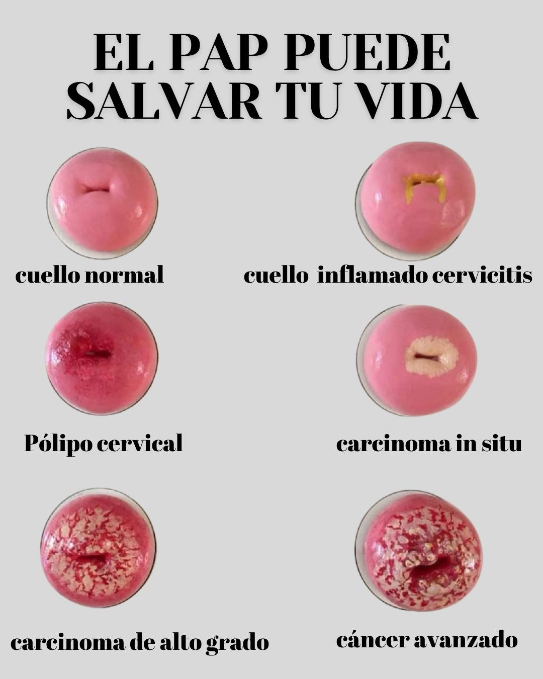 Preventive Health Facebook ad: El PAP es uno de los controles más…